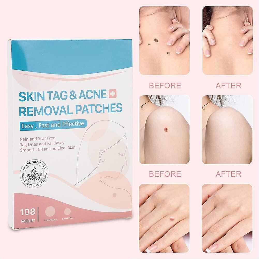 SKIN TAG - Medicinski flasteri za bubuljice, akne, bradavice