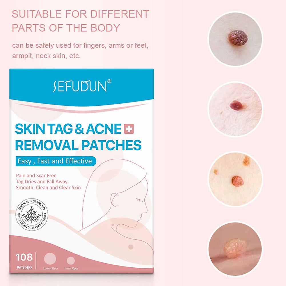 SKIN TAG - Medicinski flasteri za bubuljice, akne, bradavice